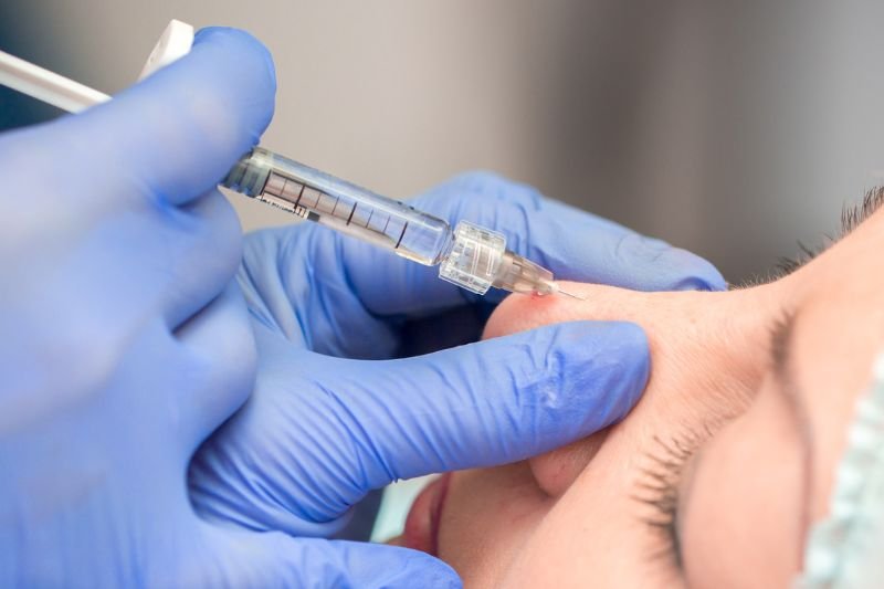 Image of prefilled Syringe for Hyaluronic Acid